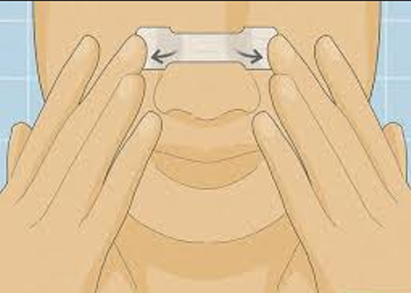 how do external nasal dilators work