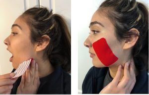 before and after tape
