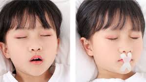 before and after using mouth tape