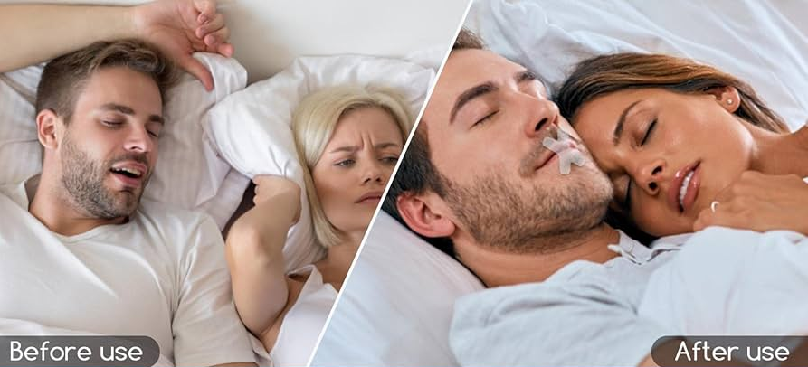 stop snoring