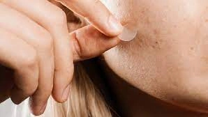 Customizable Pimple Patch
